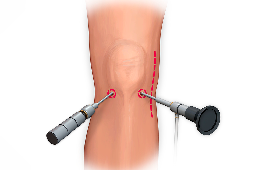 knee injury treatment