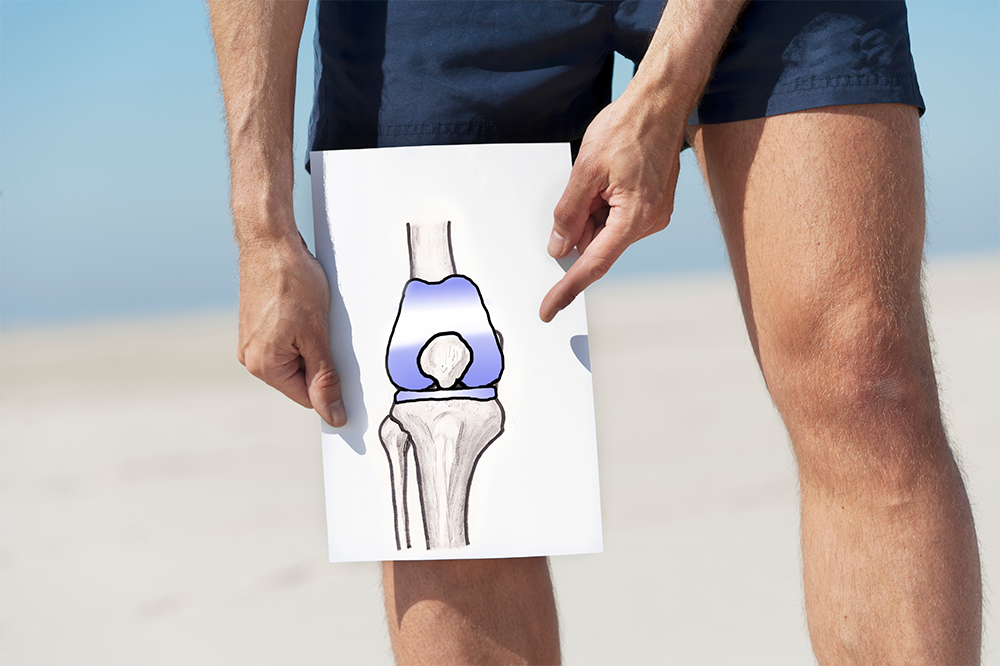 knee replacements